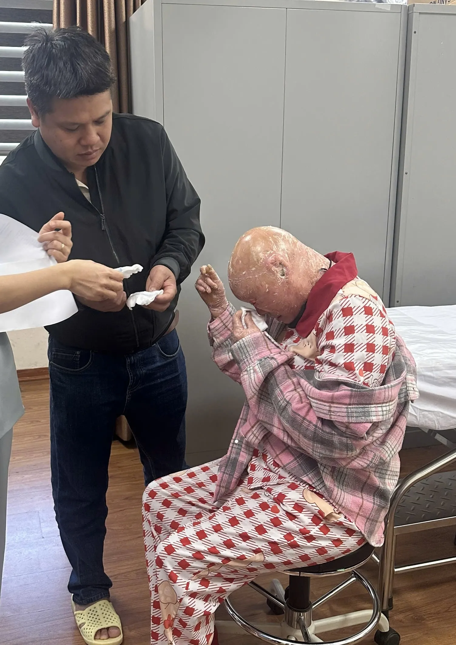 Lê Thị Hằng cùng anh trai thực hiện tái khám tại Bệnh viện Đại học Y Hà Nội.