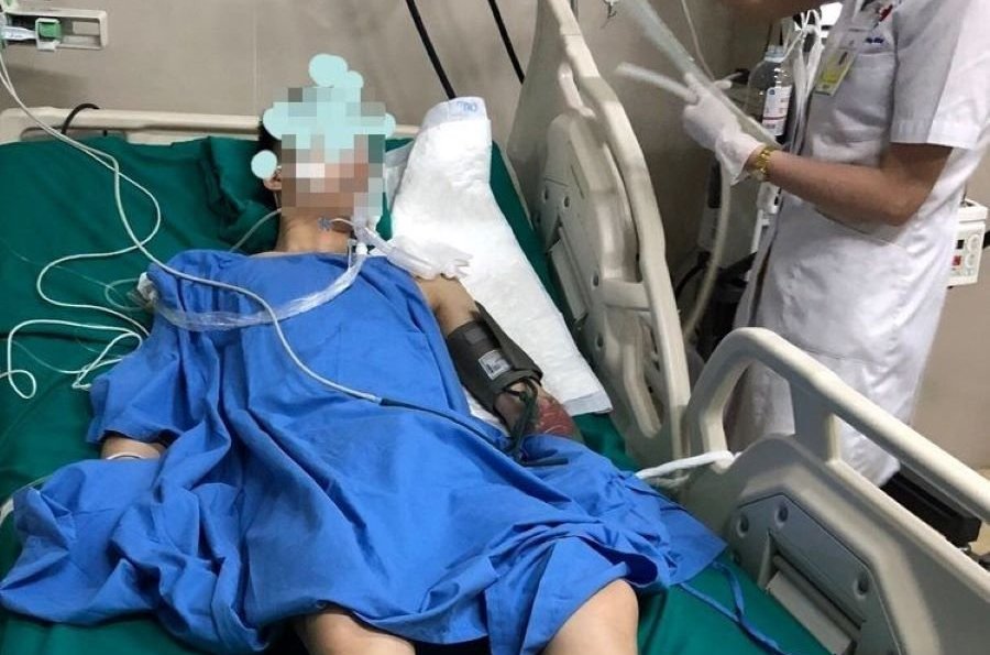 Thanh niên 25 tuổi lên cơn co giật, mất ý thức sau khi hút thuốc lào