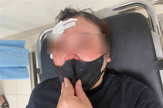 Nữ tài xế ở Hà Nội tố bị người đi ô tô dùng dùi cui vụt vào đầu